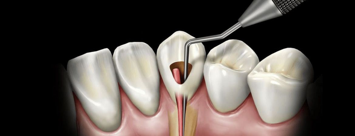 Endodontia